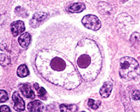 http://hematopathology.stanford.edu/images